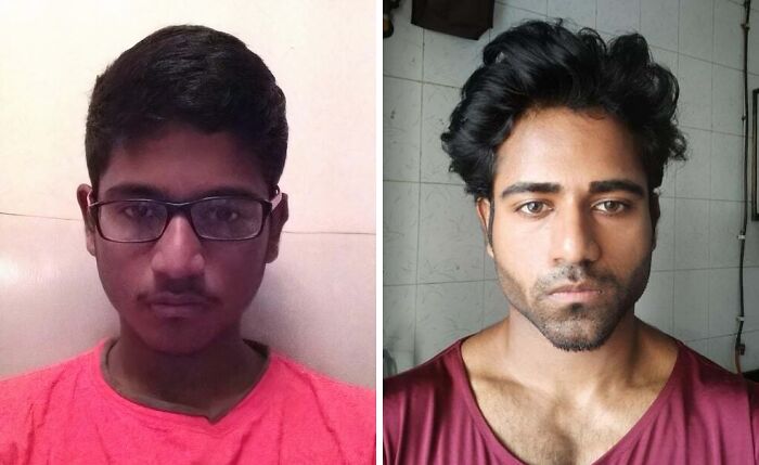 &ldquo;There Is Hope&rdquo;: 57 Glow-Ups So Extreme, People Barely Look Like The Same Person