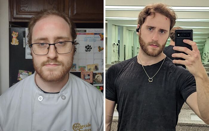 &ldquo;There Is Hope&rdquo;: 57 Glow-Ups So Extreme, People Barely Look Like The Same Person