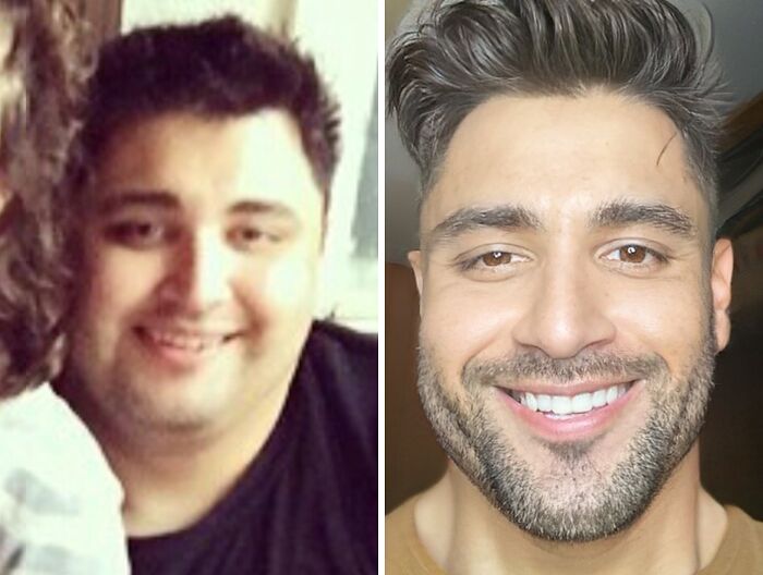 &ldquo;There Is Hope&rdquo;: 57 Glow-Ups So Extreme, People Barely Look Like The Same Person