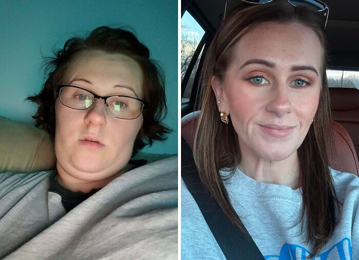 &ldquo;There Is Hope&rdquo;: 57 Glow-Ups So Extreme, People Barely Look Like The Same Person
