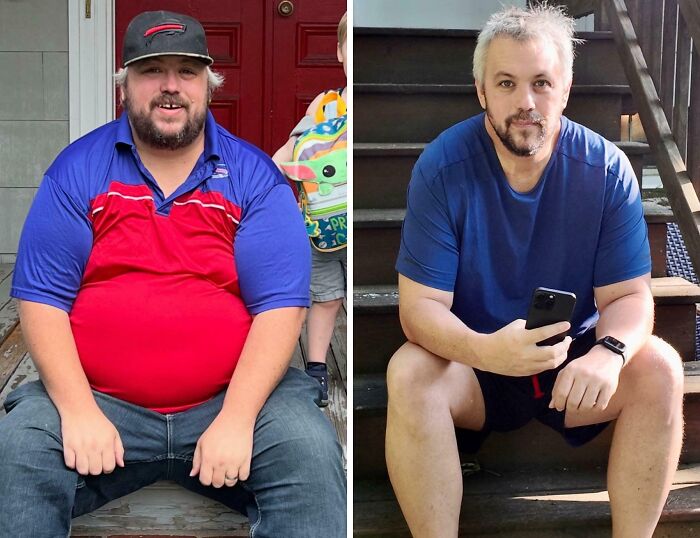 &ldquo;There Is Hope&rdquo;: 57 Glow-Ups So Extreme, People Barely Look Like The Same Person
