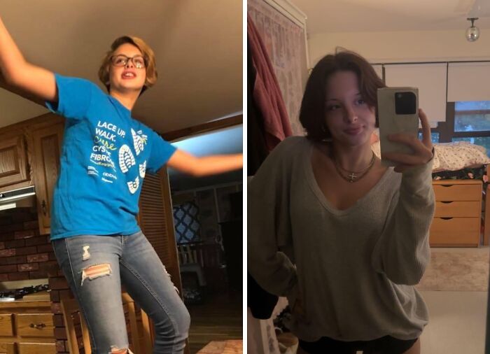 &ldquo;There Is Hope&rdquo;: 57 Glow-Ups So Extreme, People Barely Look Like The Same Person