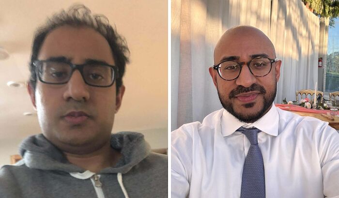 &ldquo;There Is Hope&rdquo;: 57 Glow-Ups So Extreme, People Barely Look Like The Same Person