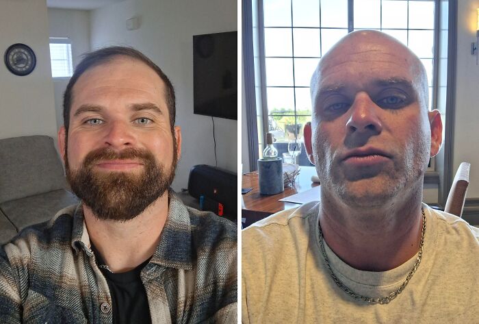 &ldquo;There Is Hope&rdquo;: 57 Glow-Ups So Extreme, People Barely Look Like The Same Person