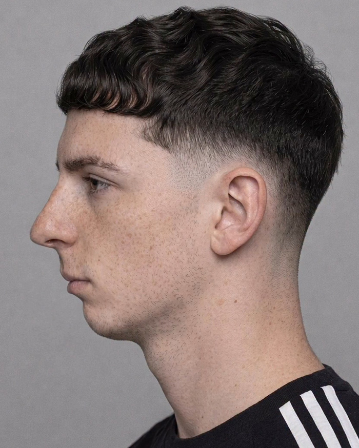 “Best Facial Harmonization I’ve Ever Seen”: 25 Before-And-Afters By A Plastic Surgeon Whose Work Went Viral