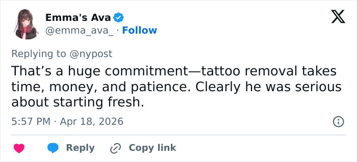 “How Does He Have $200k?”: Internet Baffled After Pete Davidson Shows Off Bare Arms Following Tattoo Removal