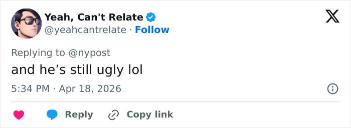 “How Does He Have $200k?”: Internet Baffled After Pete Davidson Shows Off Bare Arms Following Tattoo Removal