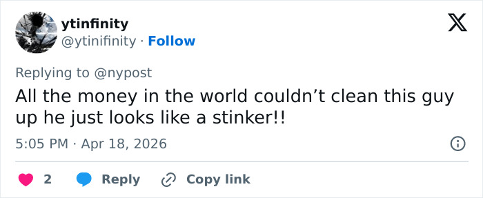 “How Does He Have $200k?”: Internet Baffled After Pete Davidson Shows Off Bare Arms Following Tattoo Removal