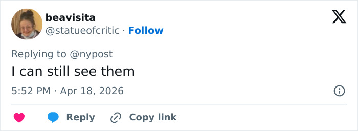 “How Does He Have $200k?”: Internet Baffled After Pete Davidson Shows Off Bare Arms Following Tattoo Removal