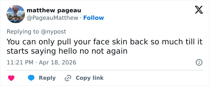 “Gravity Will Always Win”: Internet Reacts To Kris Jenner Reported Dissatisfaction With Her $100k Facelift