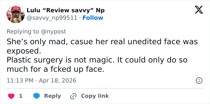 “Gravity Will Always Win”: Internet Reacts To Kris Jenner Reported Dissatisfaction With Her $100k Facelift