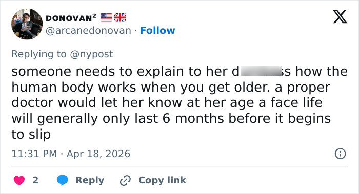 “Gravity Will Always Win”: Internet Reacts To Kris Jenner Reported Dissatisfaction With Her $100k Facelift