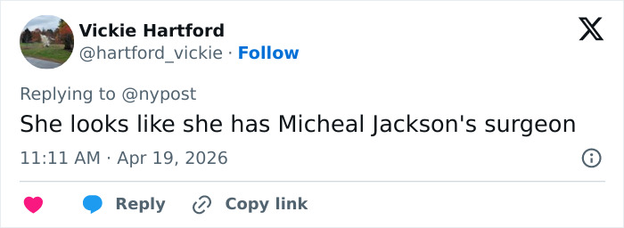 “Gravity Will Always Win”: Internet Reacts To Kris Jenner Reported Dissatisfaction With Her $100k Facelift