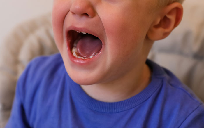 Dad Wants 35YO Daughter To Babysit 9YO Brother In France So He And Wife Can Relax Child-Free