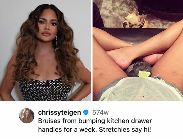 15 Celebrities Who Fought Against Unrealistic Body Standards By Being Honest And Transparent