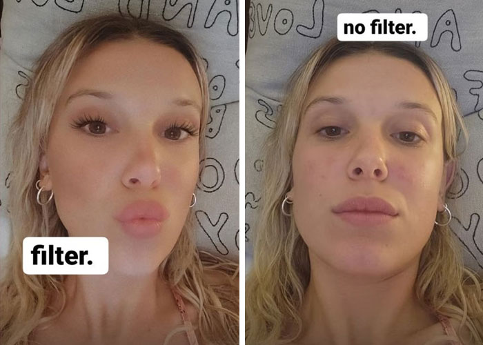 15 Celebrities Who Fought Against Unrealistic Body Standards By Being Honest And Transparent