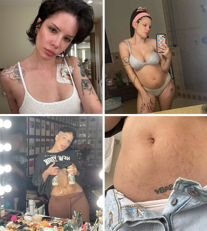 15 Celebrities Who Fought Against Unrealistic Body Standards By Being Honest And Transparent