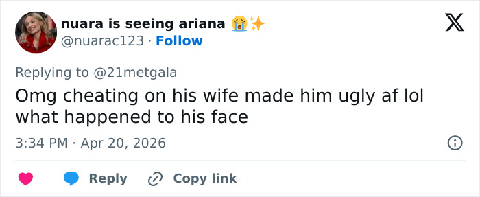 “The Milk Has Spoiled”: Adam Levine’s New Red Carpet Look Leaves Fans Stunned