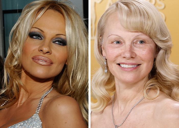 The Biggest Celebrity Fake Tan Fails After Khlo&eacute; Kardashian’s “Unrecognizable” Billboard Controversy