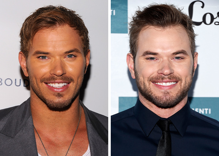 The Biggest Celebrity Fake Tan Fails After Khlo&eacute; Kardashian’s “Unrecognizable” Billboard Controversy