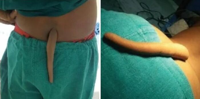 Most Of Us Walk Around Unaware Of These Bizarre Human Body Quirks – Odds Are, You Have Them Too