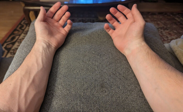 Most Of Us Walk Around Unaware Of These Bizarre Human Body Quirks – Odds Are, You Have Them Too