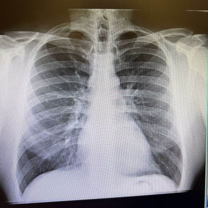 Most Of Us Walk Around Unaware Of These Bizarre Human Body Quirks – Odds Are, You Have Them Too