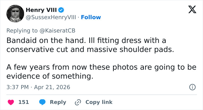 Kate Middleton’s Bandaged Hand For Late Queen Elizabeth’s Centenary Celebrations Sparks Speculation