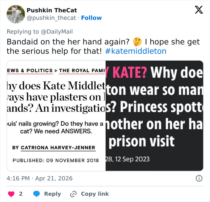 Kate Middleton’s Bandaged Hand For Late Queen Elizabeth’s Centenary Celebrations Sparks Speculation