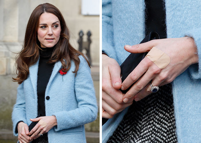 Kate Middleton’s Bandaged Hand For Late Queen Elizabeth’s Centenary Celebrations Sparks Speculation