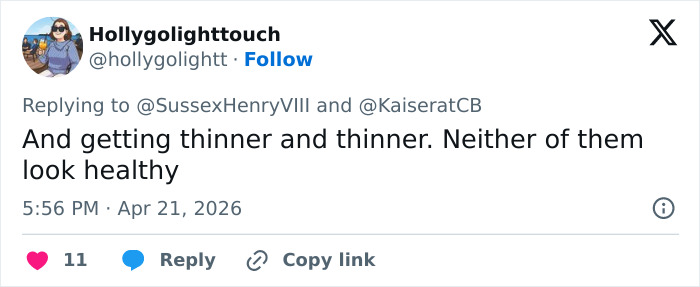 Kate Middleton’s Bandaged Hand For Late Queen Elizabeth’s Centenary Celebrations Sparks Speculation