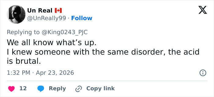 Kate Middleton’s Bandaged Hand For Late Queen Elizabeth’s Centenary Celebrations Sparks Speculation