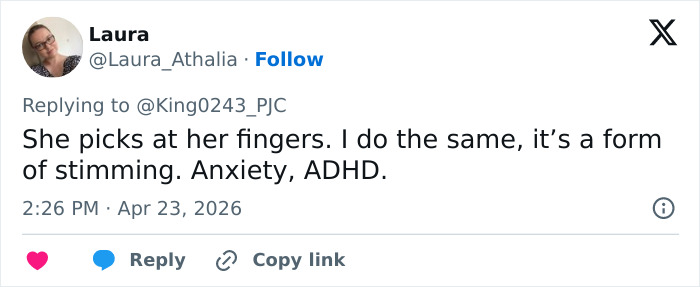 Kate Middleton’s Bandaged Hand For Late Queen Elizabeth’s Centenary Celebrations Sparks Speculation