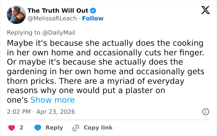 Kate Middleton’s Bandaged Hand For Late Queen Elizabeth’s Centenary Celebrations Sparks Speculation