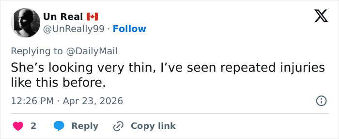 Kate Middleton’s Bandaged Hand For Late Queen Elizabeth’s Centenary Celebrations Sparks Speculation