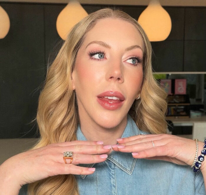 Comedian Katherine Ryan Reveals Insane Quote She Got For A Facelift From Kris Jenner’s Plastic Surgeon