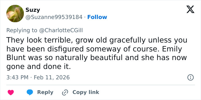 Comedian Katherine Ryan Reveals Insane Quote She Got For A Facelift From Kris Jenner’s Plastic Surgeon