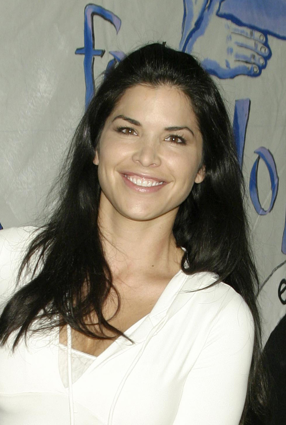 Lauren Sanchez Plastic Surgery Before And After: The “Mar-A-Lago Face” Explained