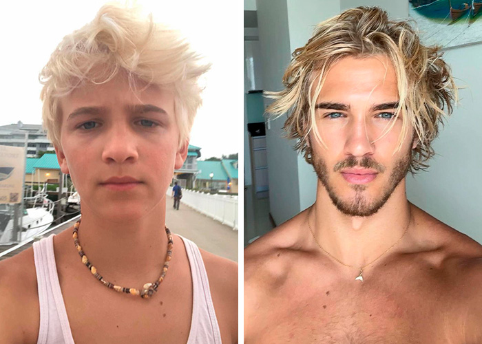 From Bone Smashing To Chin Extensions, Here Are Before-And-After Collages Of “Looksmaxxing” Influencers