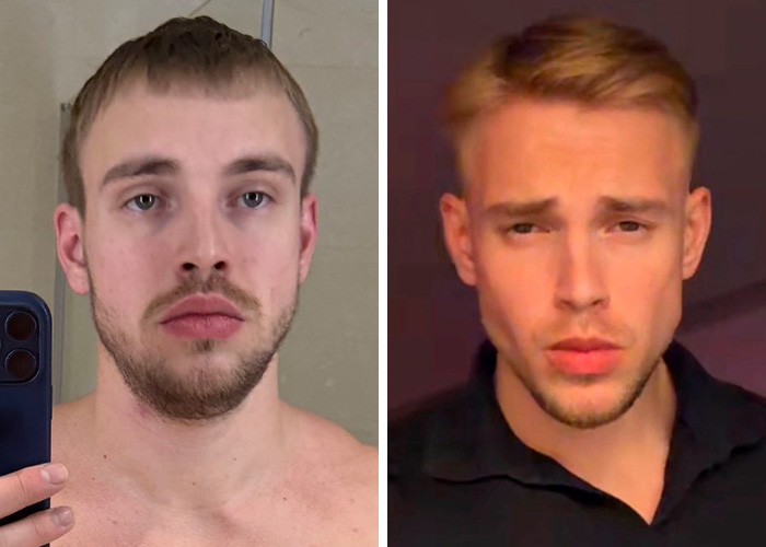 From Bone Smashing To Chin Extensions, Here Are Before-And-After Collages Of “Looksmaxxing” Influencers