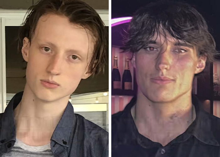 From Bone Smashing To Chin Extensions, Here Are Before-And-After Collages Of “Looksmaxxing” Influencers