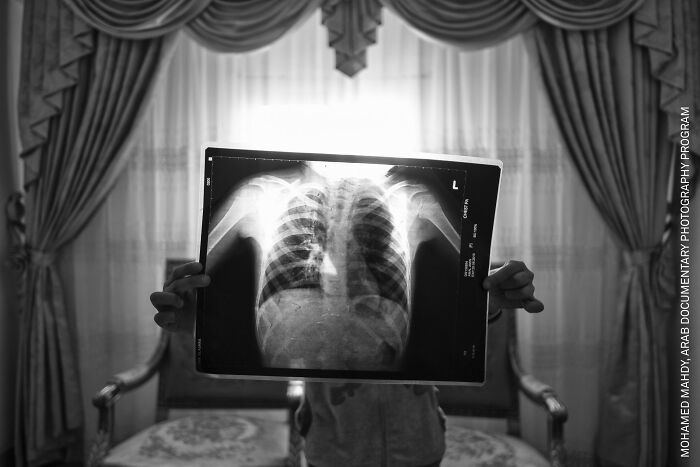 37 Powerful Photos From The 2026 World Press Photo Contest That Capture Our World Today
