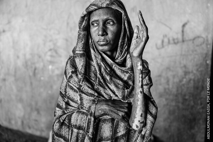 37 Powerful Photos From The 2026 World Press Photo Contest That Capture Our World Today
