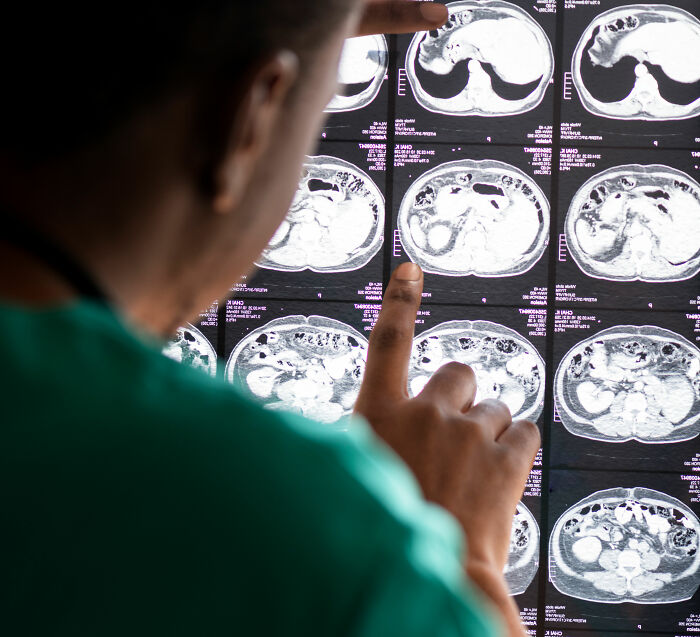 Netizens Divided After Study Reveals Habit Practiced By 18 Million Americans Can Cause Permanent Brain Damage