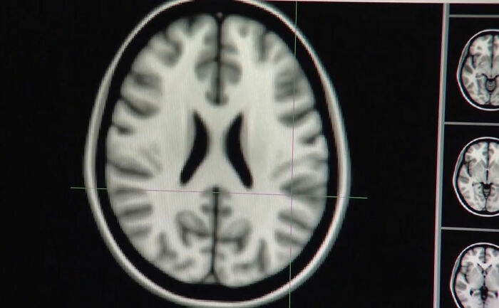 Netizens Divided After Study Reveals Habit Practiced By 18 Million Americans Can Cause Permanent Brain Damage