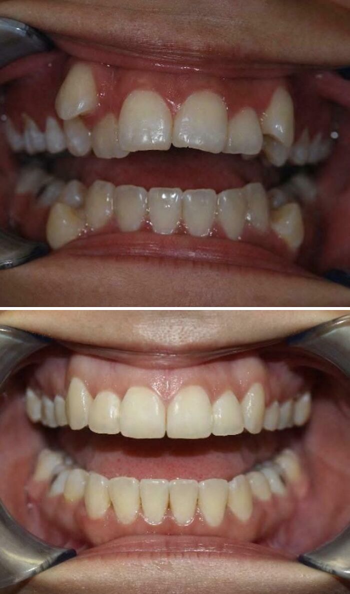 48 Side-By-Side Comparisons That Put The World Into Perspective (New Pics)