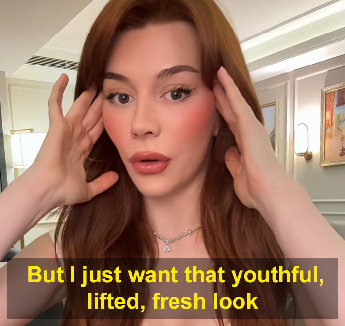 &ldquo;Ridiculously Sad&rdquo;: 28YO Woman&rsquo;s Facelift Sparks Raging Debate As People Question Society&rsquo;s New Normal