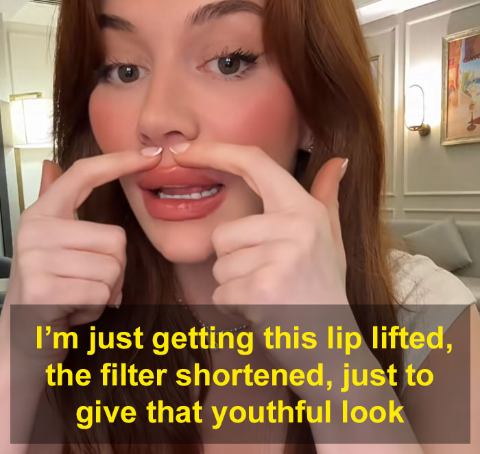 &ldquo;Ridiculously Sad&rdquo;: 28YO Woman&rsquo;s Facelift Sparks Raging Debate As People Question Society&rsquo;s New Normal