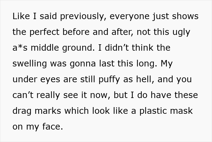 &ldquo;Ridiculously Sad&rdquo;: 28YO Woman&rsquo;s Facelift Sparks Raging Debate As People Question Society&rsquo;s New Normal