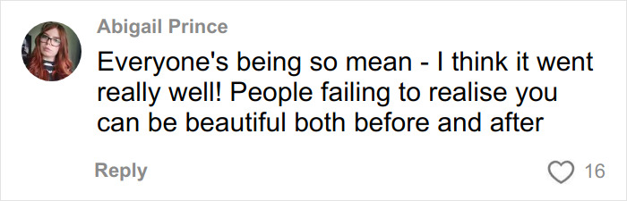 &ldquo;Ridiculously Sad&rdquo;: 28YO Woman&rsquo;s Facelift Sparks Raging Debate As People Question Society&rsquo;s New Normal